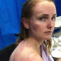 Mum Forced to Shield Baby During Terrible Hail Storm