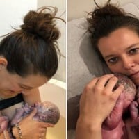 Midwife Investigated After Mum Delivers Surprise Twins During Home Birth