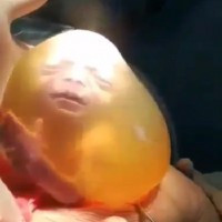 The Birth Video That Gives You a Glimpse Inside the Womb