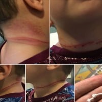 Mum Shares Warning After Son's Nasty Accident