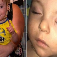 Mum Demands Answers After Baby Suffers Nasty Head Injury at Day Care