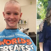 Young Girl Bullied For Shaving Her Head for Charity