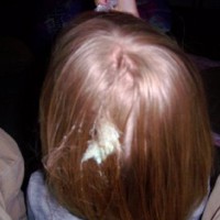 How to Easily Remove Bubble Gum From Kid's Hair