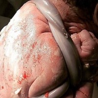 The Amazing Birth Image That Shocked Thousands