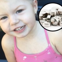 "It's Just A Virus!" Three Year Old Girl Dies After Being Misdiagnosed For Swallowing A Button Battery