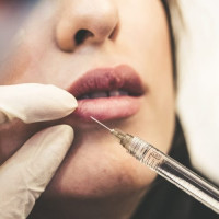 Has The Pandemic Made You Consider A Minor Cosmetic Procedure?