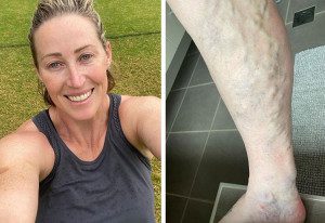 Jana Pittman twins update