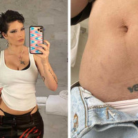 Singer Halsey's Powerful Postpartum Body Message