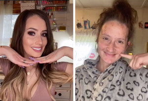 Mum loses teeth in pregnancy