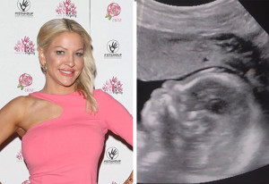 Brynne Edelsten baby