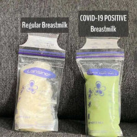 Mum Reveals Breastmilk Change After Baby Tests Covid Positive