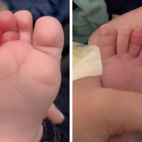 Mum's Warning: 'Check Your Baby's Toes And Fingers'