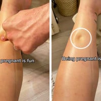 Mum's Freaky Pregnancy Symptom Is Actually Really Common