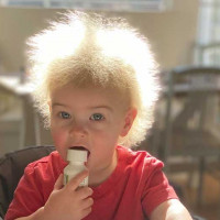 Toddler's Rare 'Uncombable Hair Syndrome' Diagnosis