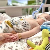 Four-Month-Old Battles Japanese Encephalitis Virus