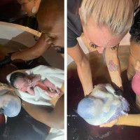 Incredible Twin En Caul Birth Images