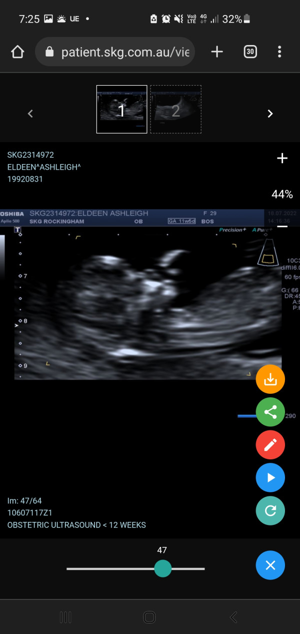 Win 1 Of 6 Thermacell Portable Repeller Packs! Competition