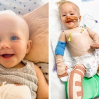 Toddler Loses Legs To Common Infection: 'Always Trust Your Gut'