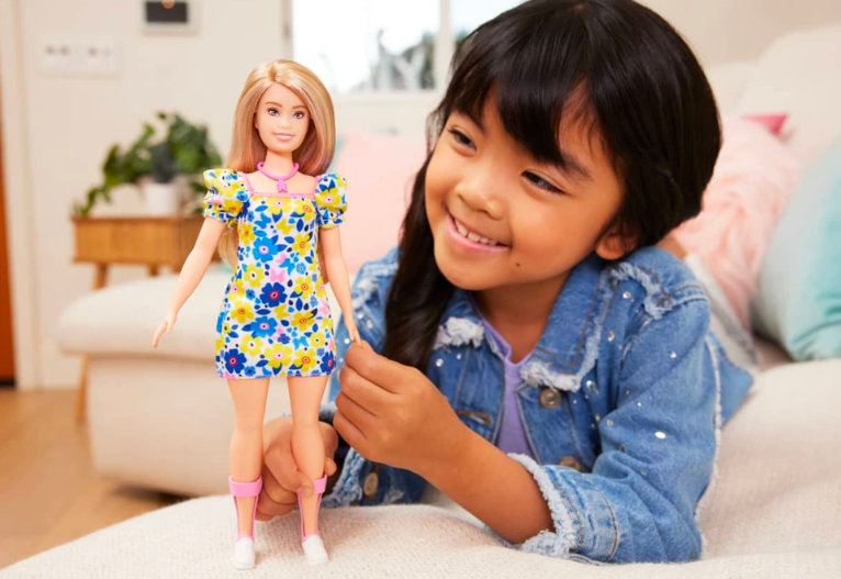 Barbie Down syndrome