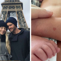 Chad Michael Murray Welcomes Baby Girl With Incredible Birthmark