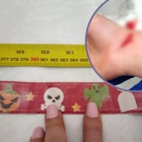 Mum's Warning: 'I Couldn't Believe A Slap Band Could Cause This'