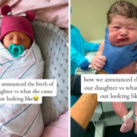 Parents Share Hilarious 'Ugly' Newborn Photos And We Can't Cope