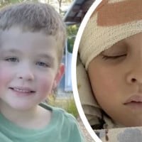 Six-Year-Old Boy Suffers Horrific Classroom Injury